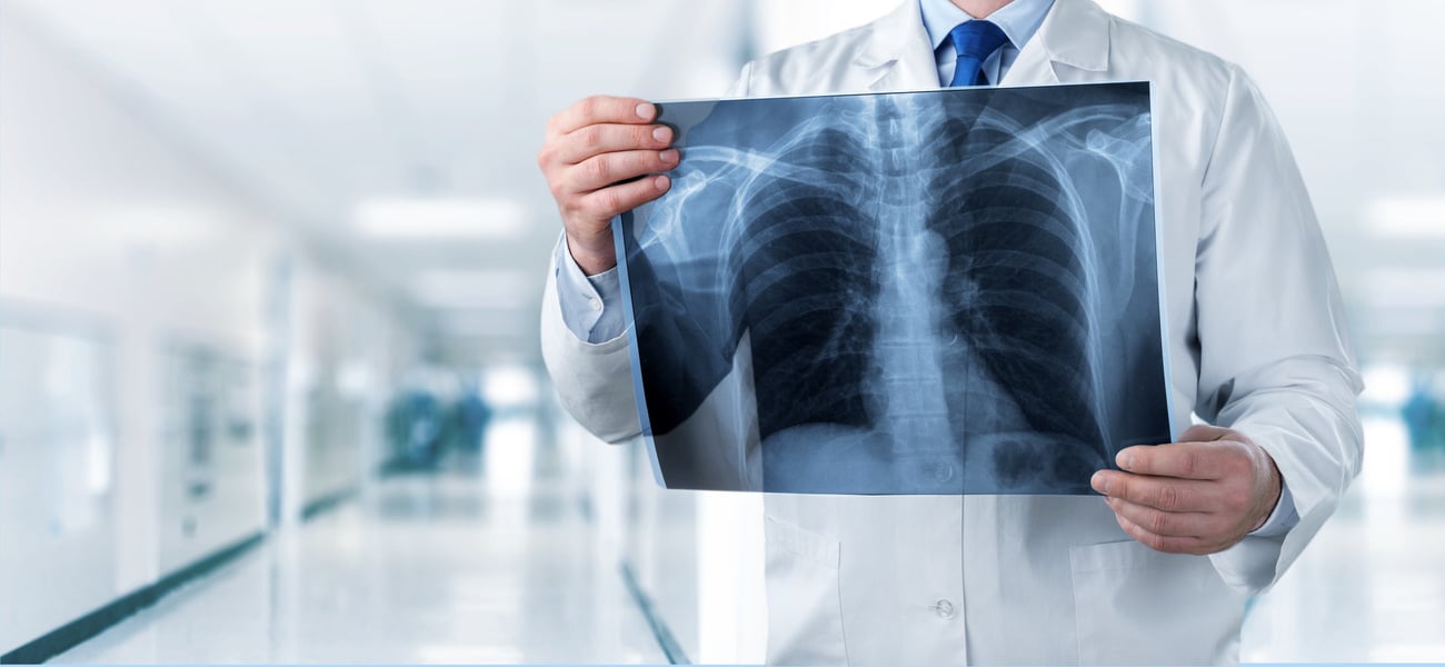 Xray Radiology Doctor Hospital Disease Radiography Ray